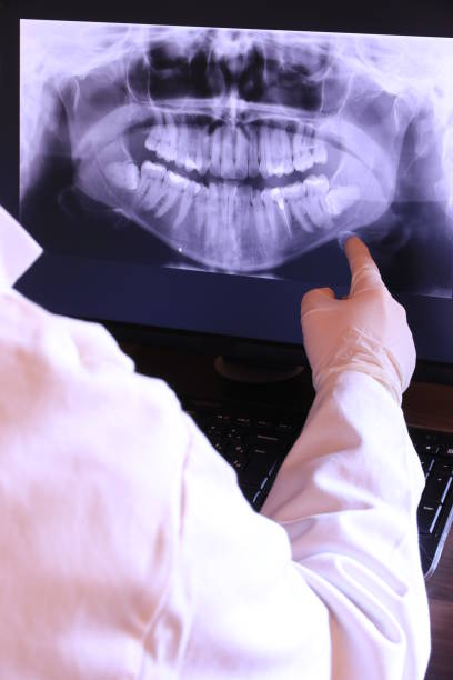 Best Emergency Root Canal Treatment in Rockcreek, OR
