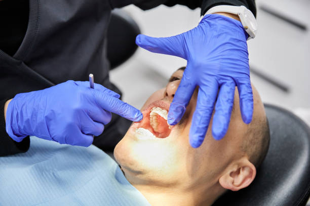 Best Emergency Tooth Extraction in Rockcreek, OR