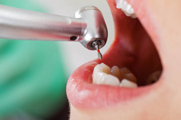 Best Walk-In Emergency Dentist in Rockcreek, OR